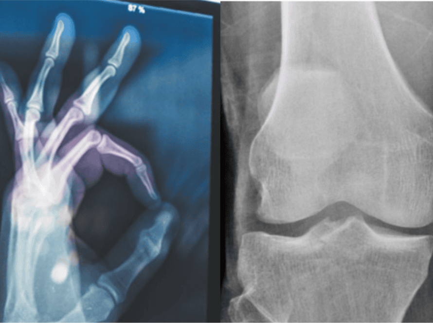 Increased blood flow - sore joints article