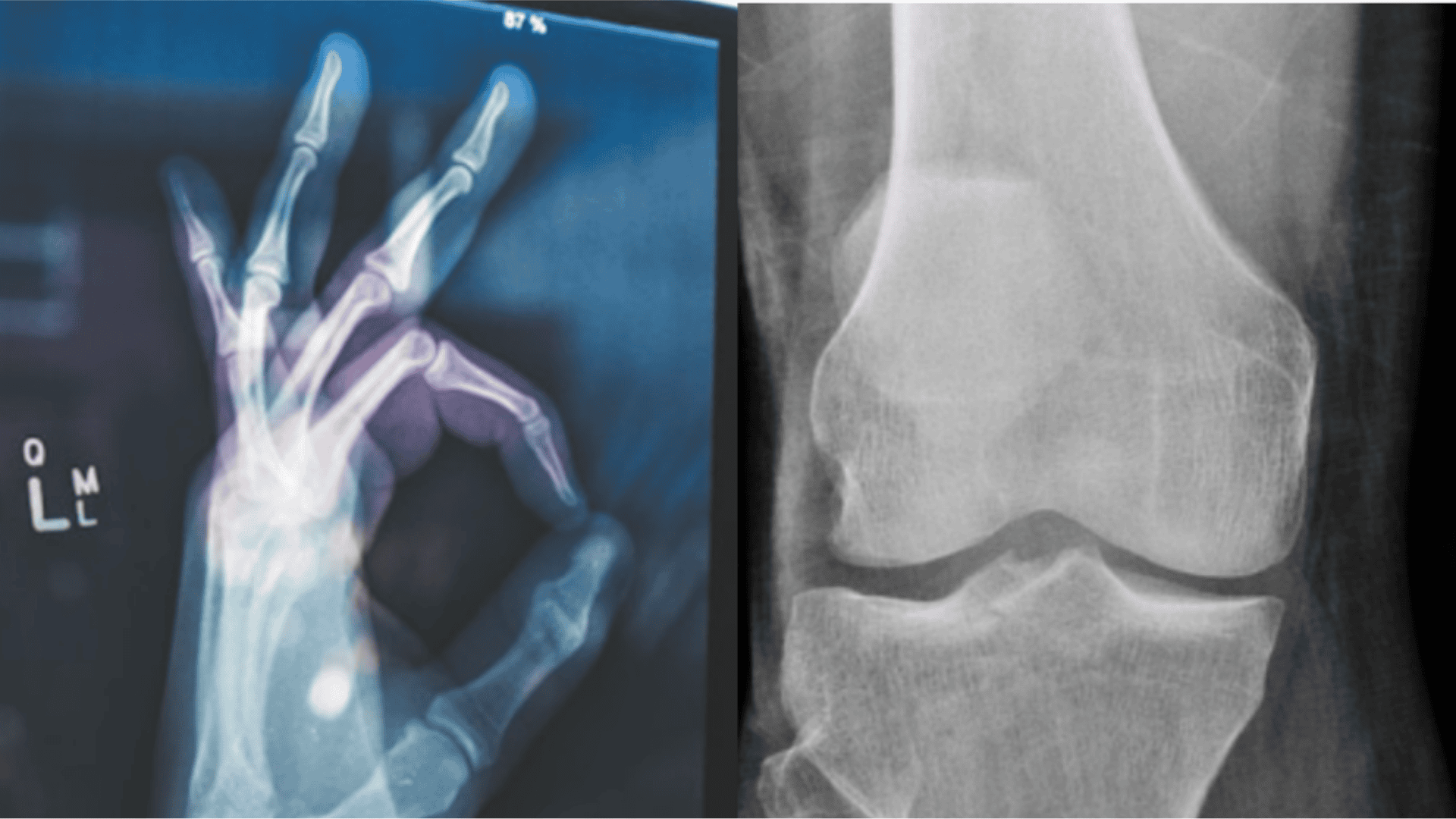Increased blood flow - sore joints article